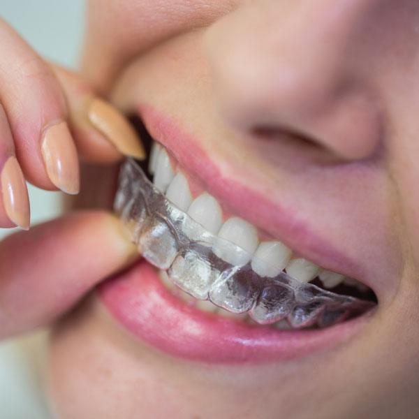 Attractive Young Woman Getting Evaluated for Veneers at a Dentists Offiice