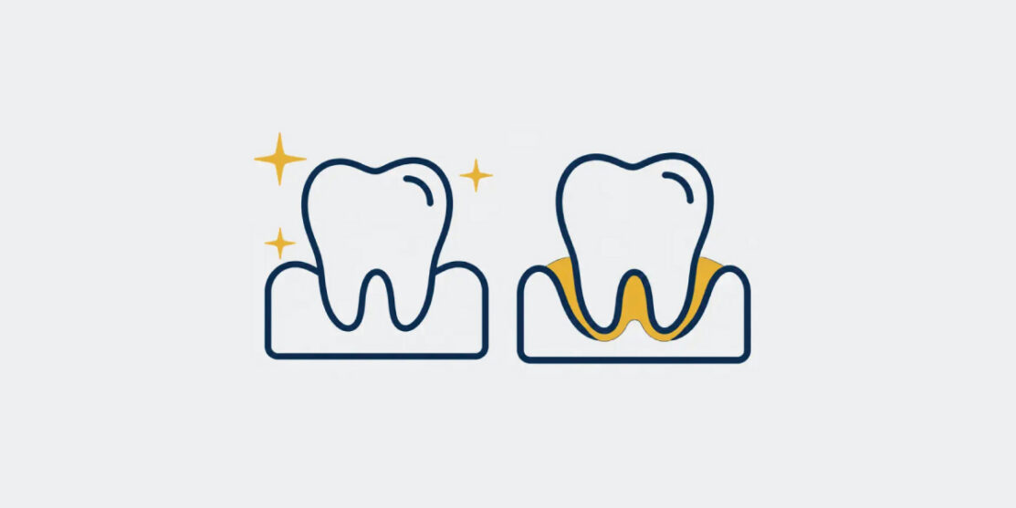 Navy and gold paired tooth icons representing routine and deep dental cleanings