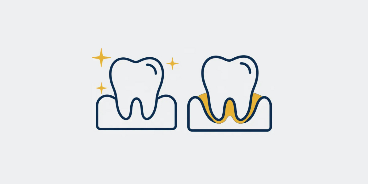 Navy and gold paired tooth icons representing routine and deep dental cleanings