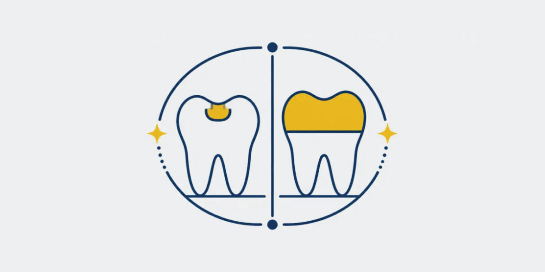 Navy and gold tooth icons comparing a dental filling with a protective crown
