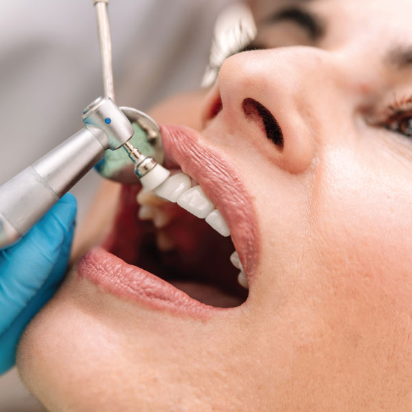 Dental Cleaning with Polishing Brush