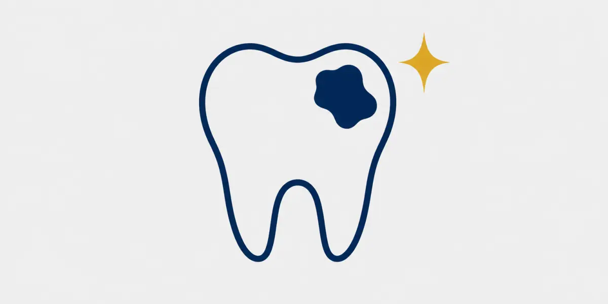 Illustration of a tooth with a visible cavity.