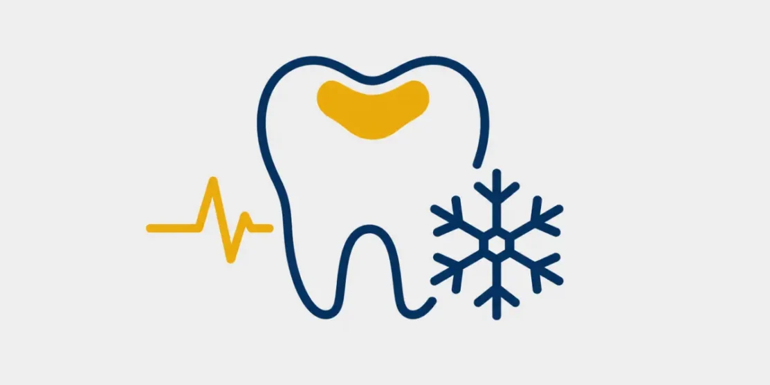 Illustration of a filled tooth with a snowflake and pulse representing sensitivity after a filling.