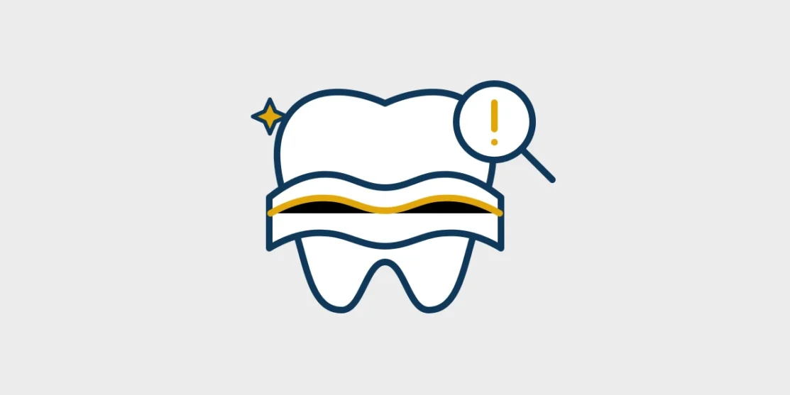 Navy and gold line illustration of a tooth and gumline under examination on a light gray background
