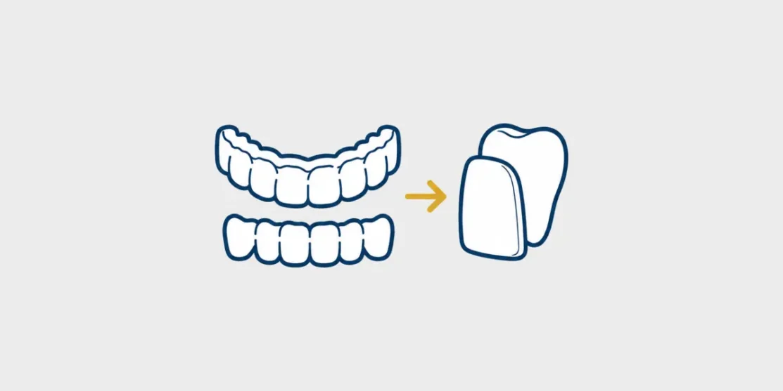 Navy and gold line icon of clear aligners and a veneer connected by a planning arrow on a light gray background