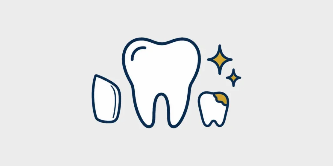 Line icon comparing a veneer, natural tooth, bonding repair, and whitening sparkles